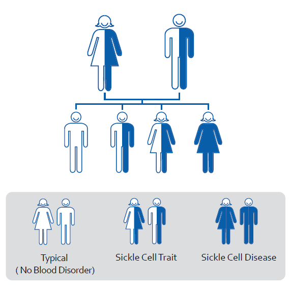 What is Sickle Cell Disease? MTS Sickle Cell Foundation